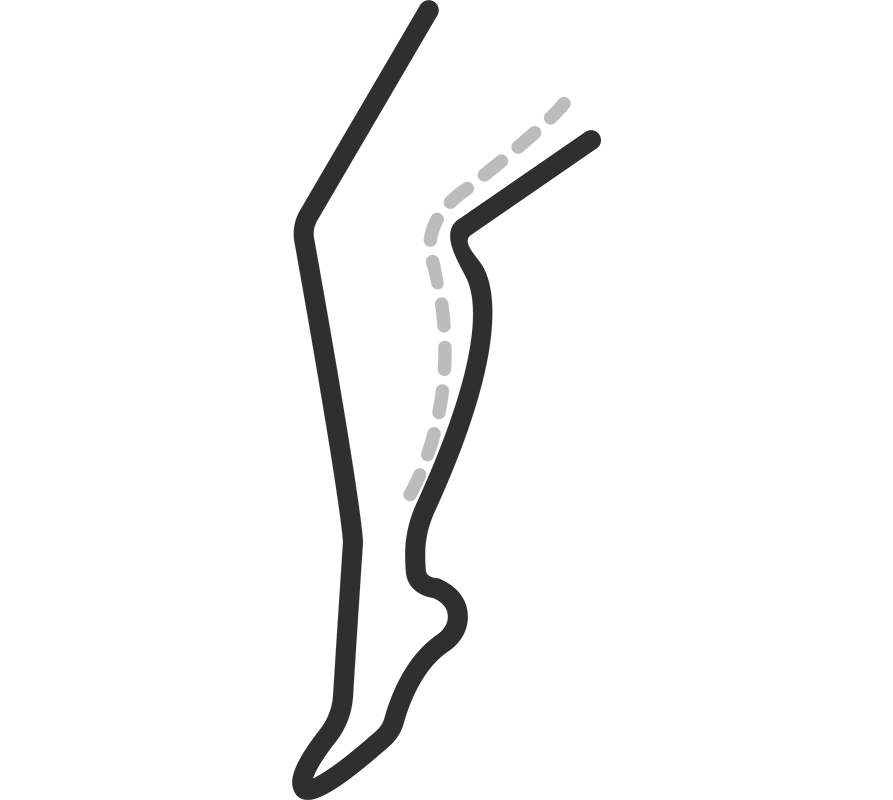 Thighs - Areas we Treat | DermaClinic Center - We are Leaders in Aesthetic Treatments